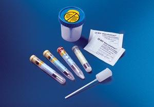 Urine Transfer Straw Kit: 8mL Draw, 16 x 100mm UA Preservative Plus Plastic Conical Bottom Tube, & Urine Transfer Straw, 50/bx, 4 bx/cs (Temp Sensitive; Non-Returnable) (Drop Ship Requires Pre-Approval)